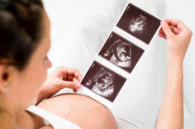 Pregnant Woman Reviewing Baby Ultrasound Scan