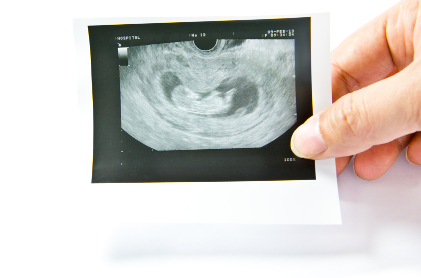 MD.Saúde - Ao contrário do que muitas pessoas acreditam, não existem  sintomas de gravidez nos primeiros dias após a fecundação. Os primeiros  sinais surgem somente quando o embrião implanta-se no útero, evento