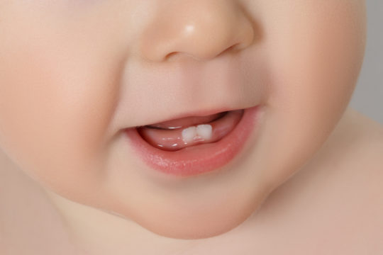 Estudo aponta que não há relação entre febre e nascimento dos dentes