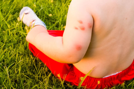 Como proteger seu bebê de picadas de mosquitos?