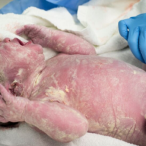 O primeiro banho do recém-nascido e o Vérnix